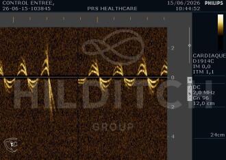 Philips EnVisor C HD Ultrasound - 8