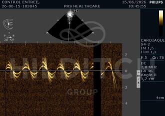 Philips EnVisor C HD Ultrasound - 9