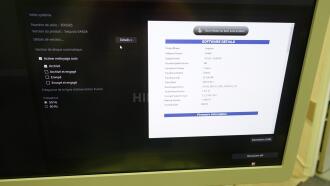 Siemens Acuson Sequoia Ultrasound - 4