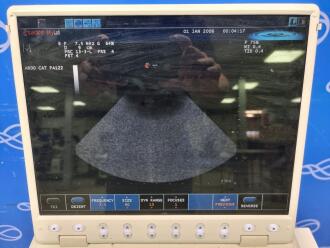 Esaote MyLab 25 Portable Ultrasound on Trolley - No HDD - 5