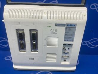 Chison EBit 60 Portable Ultrasound - No HDD - 3