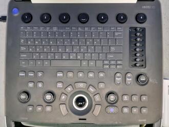 Samsung Medison HM70 EVO Portable Ultrasound - 4