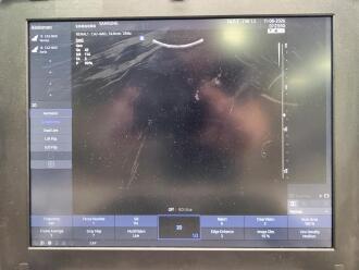 Samsung Medison HM70 EVO Portable Ultrasound - 5