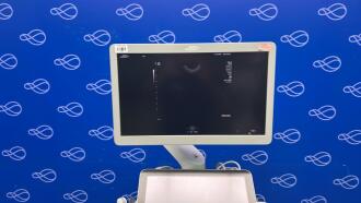 Siemens Acuson Sequoia Ultrasound - 4