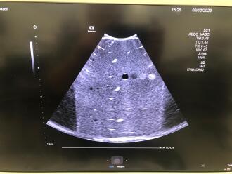 Siemens Acuson Sequoia 2.0 Ultrasound *NO BUYERS PREMIUM* - 9