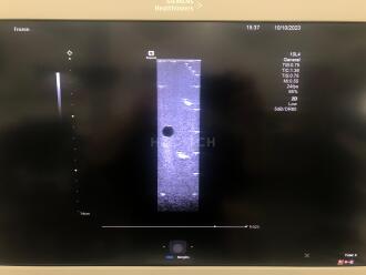 Siemens Acuson Sequoia 2.0 Ultrasound *NO BUYERS PREMIUM* - 9