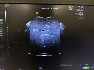 Siemens Acuson Redwood Ultrasound *NO BUYERS PREMIUM* - 7