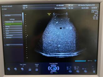 GE Voluson P6 Ultrasound *NO BUYERS PREMIUM* - 9