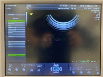 GE Voluson P6 Ultrasound *NO BUYERS PREMIUM* - 15