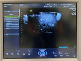 GE Voluson P6 Ultrasound *NO BUYERS PREMIUM* - 16