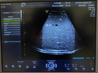 GE Voluson P6 Ultrasound *NO BUYERS PREMIUM* - 18