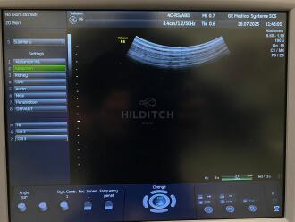 GE Voluson P6 Ultrasound *NO BUYERS PREMIUM* - 19