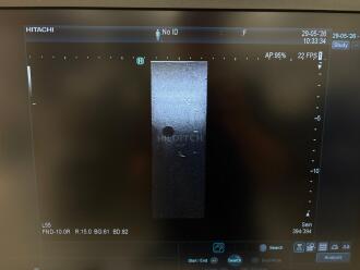 Hitachi Arietta 850 Ultrasound *NO BUYERS PREMIUM* - 9