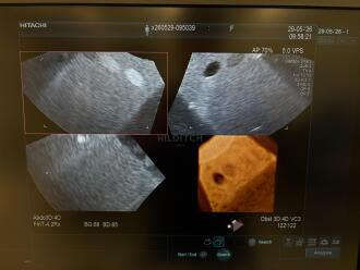 Hitachi Arietta 850 Ultrasound *NO BUYERS PREMIUM* - 14