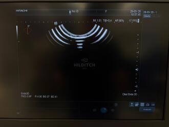 Hitachi Arietta 850 Ultrasound *NO BUYERS PREMIUM* - 18