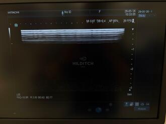 Hitachi Arietta 850 Ultrasound *NO BUYERS PREMIUM* - 19