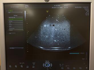 GE Voluson S6 Ultrasound *NO BUYERS PREMIUM* - 11