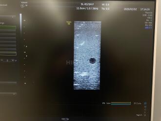 GE Voluson S6 Ultrasound *NO BUYERS PREMIUM* - 10