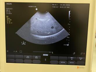 Philips CX50 Ultrasound&Acirc; *NO BUYERS PREMIUM* - 12
