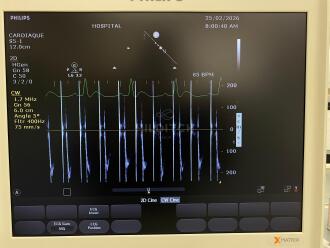 Philips CX50 Ultrasound&Acirc; *NO BUYERS PREMIUM* - 13