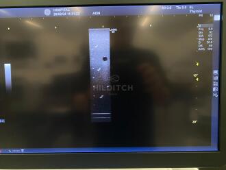 GE Logiq E9 XDclear 2.0 Ultrasound *NO BUYERS PREMIUM* - 11