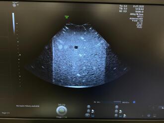 GE Voluson E8 BT21 Ultrasound *NO BUYERS PREMIUM* - 10