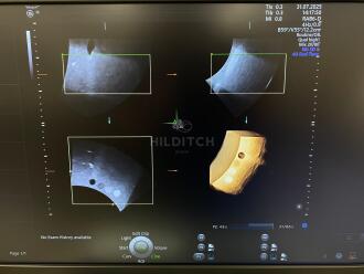 GE Voluson E8 BT21 Ultrasound *NO BUYERS PREMIUM* - 11