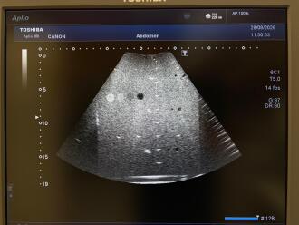Canon Aplio 300 Ultrasound *NO BUYERS PREMIUM* - 11