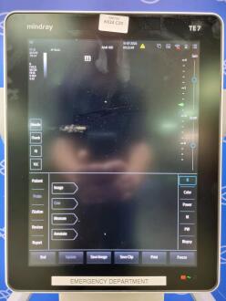 Mindray TE 7 Portable Ultrasound on Trolley - No HDD - 4