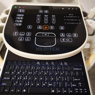 Philips Sparq Ultrasound - 11