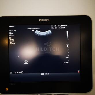 Philips Sparq Ultrasound - 16