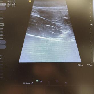 Siemens Acuson S2000 Ultrasound - 13