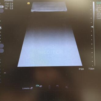 Siemens Acuson S2000 Ultrasound - 18