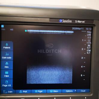 Sonosite S-Nerve Ultrasound - 20