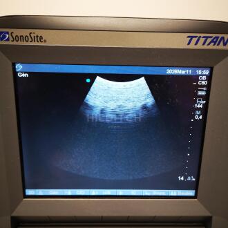 Sonosite Titan Ultrasound - 16