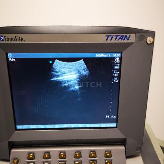 Sonosite Titan Ultrasound - 17