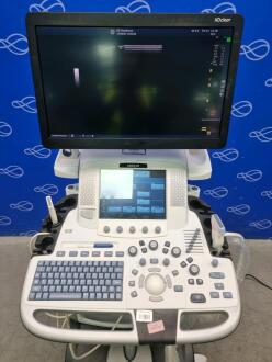 GE Logiq E9 with XDclear Ultrasound System - 4