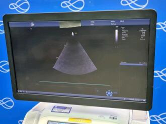 GE Vivid E95 v201 Ultrasound - 2