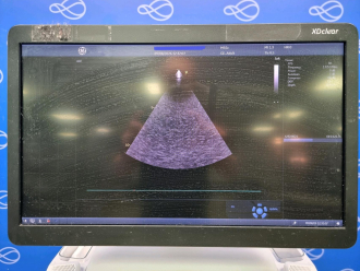 GE Vivid E95 Ultrasound - 5