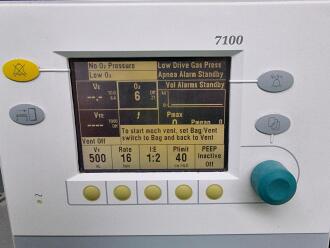 Datex-Ohmeda Aespire Anaesthetic Machine - 3