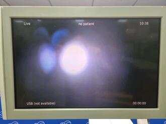 Zeiss OPMI Lumera 700 Operating Microscope - 3