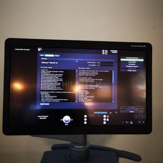 GE Voluson E10 BT17 Ultrasound - 15