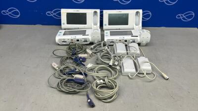 4 x Welch Allyn Connex Spot Monitors