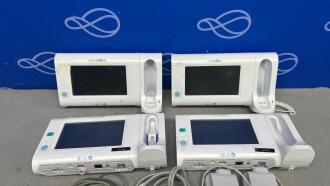 4 x Welch Allyn Connex Spot Monitors - 2