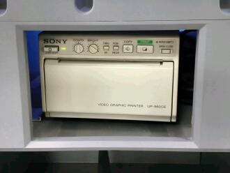 Sonosite Titan High Resolution Ultrasound System on Sonosite Titan Trolley - 4
