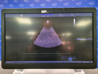 GE Vivid E95 Ultrasound - 7
