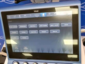 GE Vivid S60 Ultrasound - 5