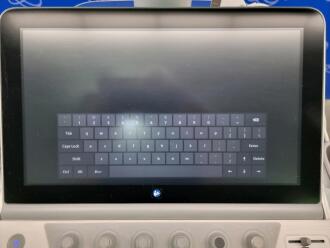Siemens Acuson Sequoia Ultrasound - 5