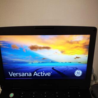 GE Versana Active 1.5 Ultrasound - 6