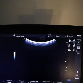 GE Versana Active 1.5 Ultrasound - 13